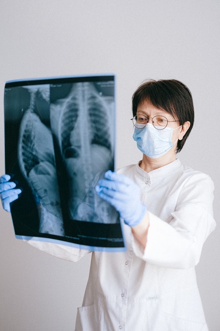 A doctor looks at xrays